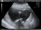 A sample thumbnail from a photo album entitled 'It's a Boy! (1/3)'